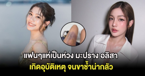 แฟนๆแห่เป็นห่วง มะปราง อลิสา เกิดอุบัติเหตุ จนขาช้ำน่ากลัว
