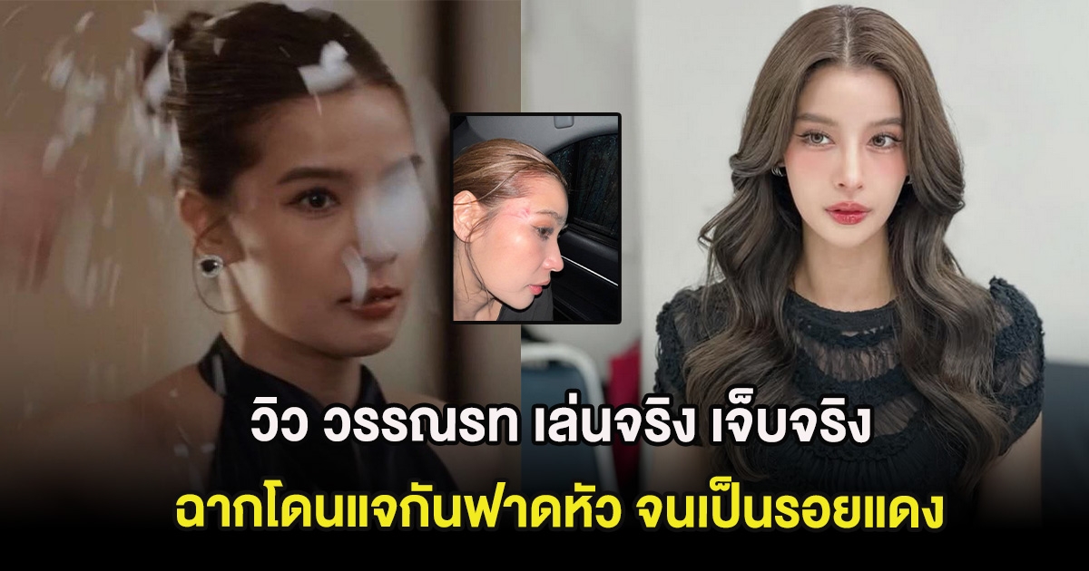 วิว วรรณรท เล่นจริง เจ็บจริง ฉากโดนแจกันฟาดหัว จนเป็นรอยแดง