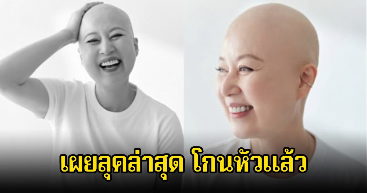 แฟนๆส่งกำลังใจ ตลกสาวชื่อดัง โกนหัวแล้ว หลังเพิ่งเข้ารับการรักษามะเร็ง (ข่าวต่างประเทศ)