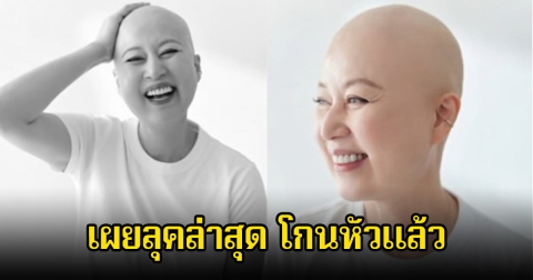 แฟนๆส่งกำลังใจ ตลกสาวชื่อดัง โกนหัวแล้ว หลังเพิ่งเข้ารับการรักษามะเร็ง (ข่าวต่างประเทศ)