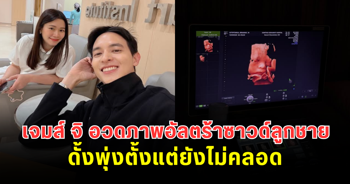 เจมส์ จิ อวดภาพอัลตร้าซาวด์ลูกชาย ดั้งพุ่งตั้งแต่ยังไม่คลอด