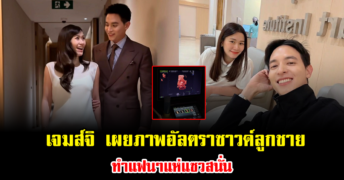 เจมส์จิ เผยภาพอัลตราซาวด์ลูกชาย แฟนๆแห่แซวสนั่นดั้งโด่งมาก