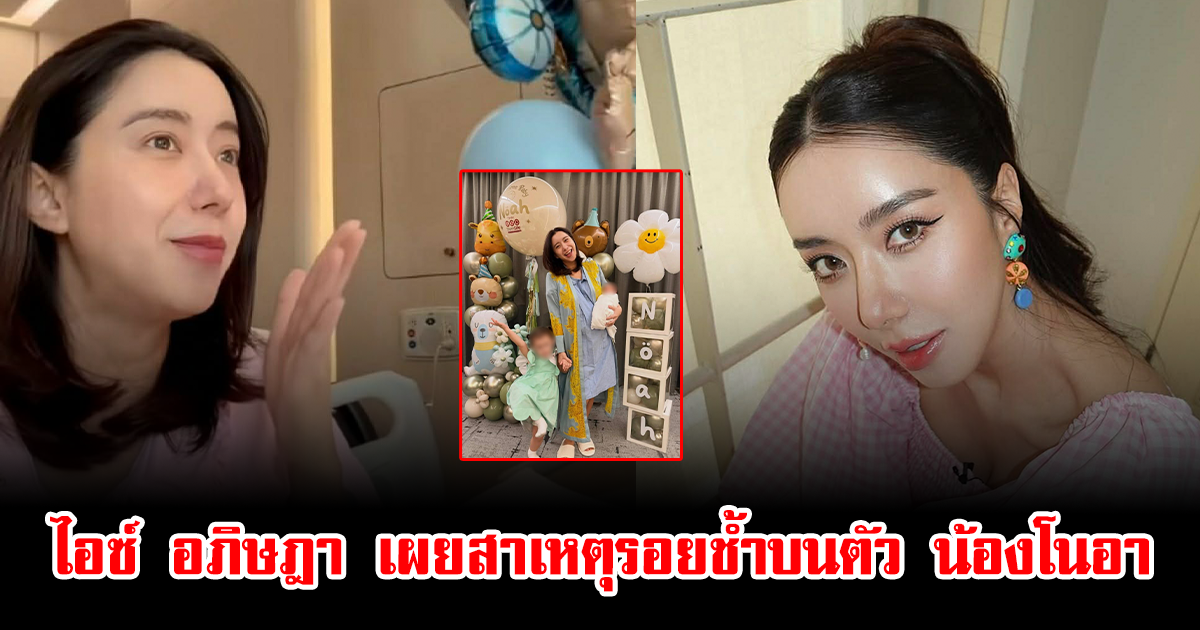 แฟนๆเป็นห่วง หลังเห็นน้องโนอา ลูก ไอซ์ อภิษฎา มีรอยช้ำบนตัว ล่าสุดเผยสาเหตุแล้ว