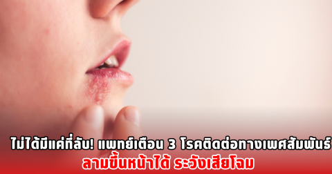 ไม่ได้มีแค่ที่ลับ! แพทย์เตือน 3 โรคติดต่อทางเพศสัมพันธ์ ลามขึ้นหน้าได้ ระวังเสียโฉม