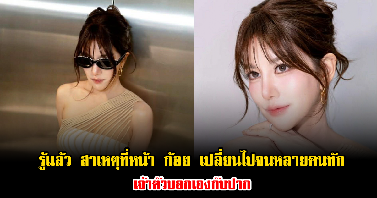 รู้แล้ว สาเหตุที่หน้า ก้อย รัชวิน เปลี่ยนไปจนหลายคนทัก เจ้าตัวบอกเองกับปาก