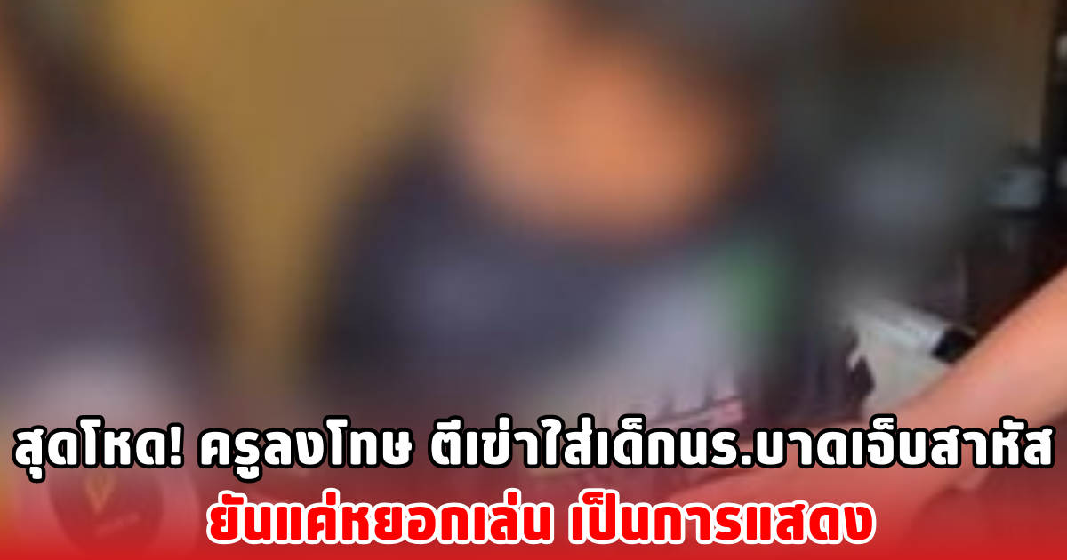 สุดโหด! ครูลงโทษ ตีเข่าใส่เด็กนร.บาดเจ็บสาหัส ยันแค่หยอกเล่น เป็นการแสดง