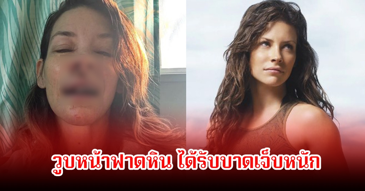 แฟนช็อก! นักเเสดงสาว วูบหน้าฟาดหิน ได้รับบาดเจ็บหนัก (ข่าวต่างประเทศ)