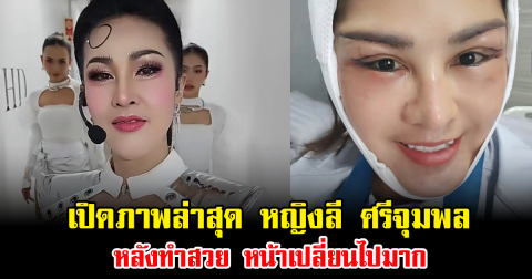 จำแทบไม่ได้ เปิดภาพล่าสุด หญิงลี ศรีจุมพล หลังทำสวย หน้าเปลี่ยนไปมาก