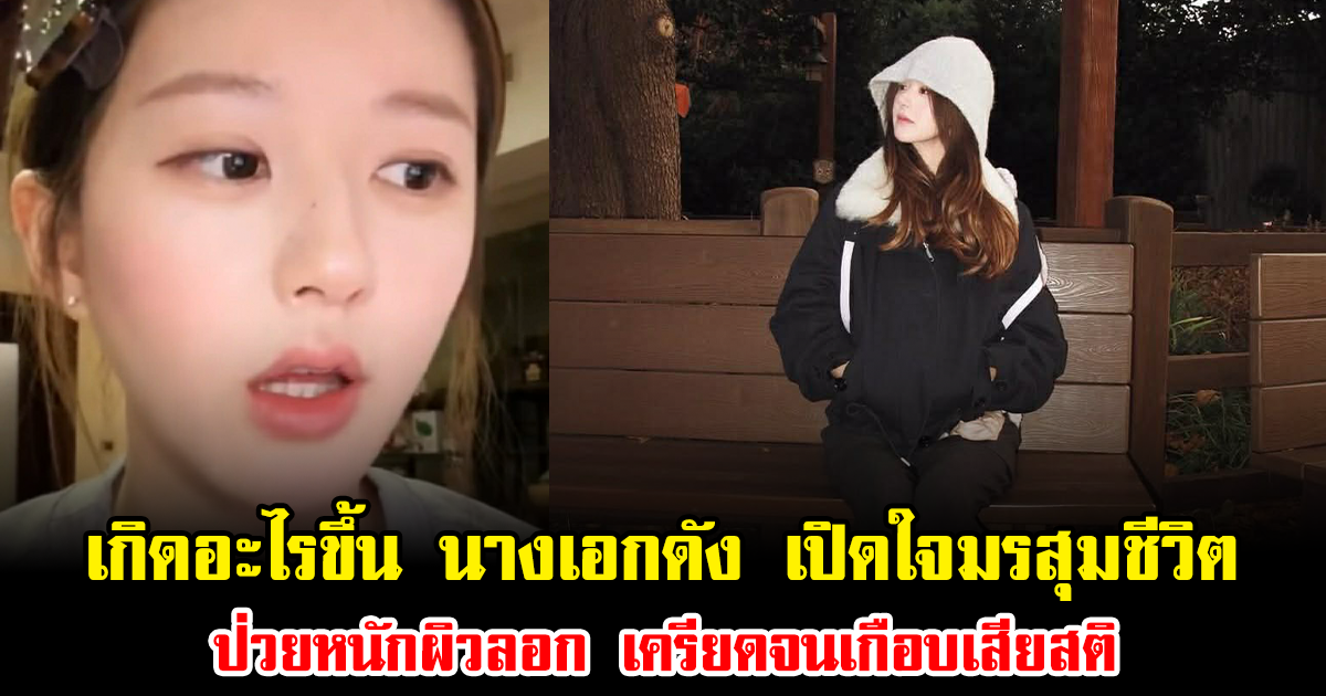 เกิดอะไรขึ้น นางเอกดัง เปิดใจมรสุมชีวิต ป่วยหนักผิวลอก เครียดจนเกือบเสียสติ (ข่าวต่างประเทศ)