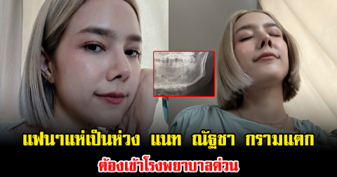 แฟนๆแห่เป็นห่วง แนท ณัฐชา กรามแตก ต้องเข้าโรงพยาบาลด่วน