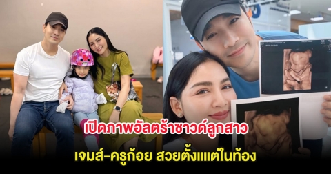 เปิดภาพอัลตร้าซาวด์ลูกสาว เจมส์-ครูก้อย สวยตั้งแแต่ในท้อง