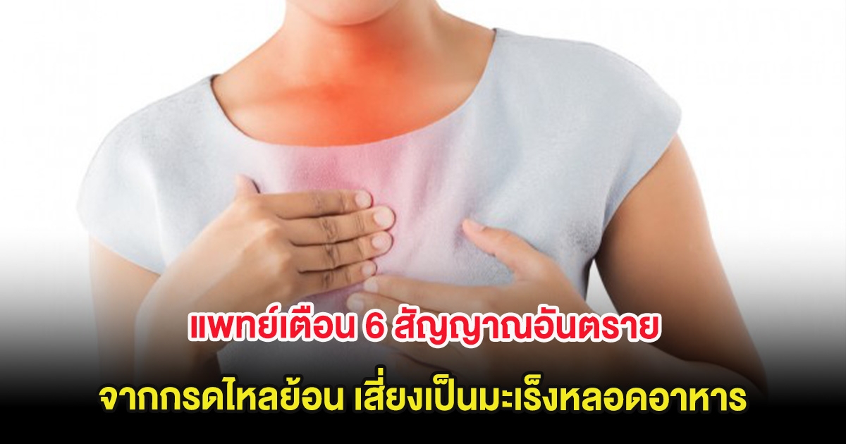 แพทย์เตือน 6 สัญญาณอันตราย จากกรดไหลย้อน เสี่ยงเป็นมะเร็งหลอดอาหาร