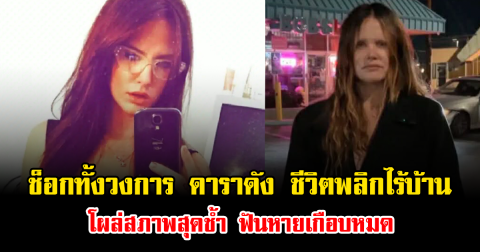 ช็อกทั้งวงการ ดาราดัง ชีวิตพลิกไร้บ้าน โผล่สภาพสุดช้ำ ฟันหายเกือบหมด (ข่าวต่างประเทศ)