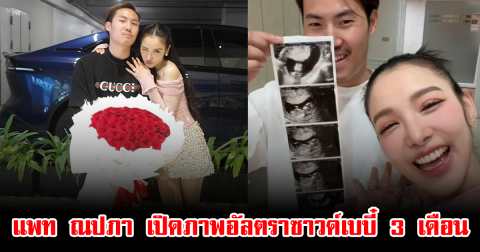 แพท ณปภา เปิดภาพอัลตราซาวด์เบบี๋ 3 เดือน แฟนๆแห่ยินดีเพียบ
