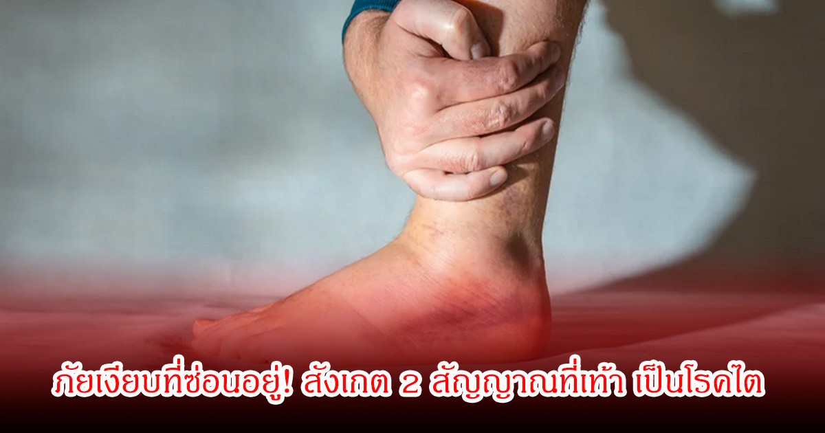 ภัยเงียบที่ซ่อนอยู่! สังเกต 2 สัญญาณที่เท้า เป็นโรคไต หลายคนเป็นไม่รู้ตัว