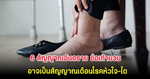6 สัญญาณอันตราย ข้อเท้าบวม อาจเป็นสัญญาณเตือนโรคหัวใจ-ไต