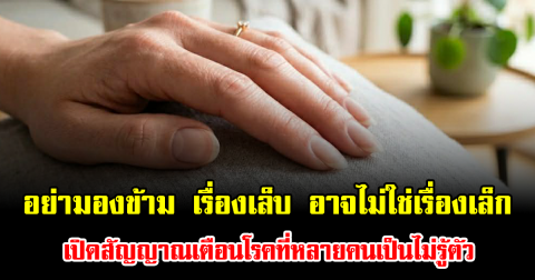 อย่ามองข้าม เรื่องเล็บ อาจไม่ใช่เรื่องเล็ก เปิดสัญญาณเตือนโรคที่หลายคนเป็นไม่รู้ตัว