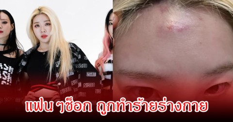 นักร้องสาว ได้รับบาดเจ็บ เกิดเหตุทะเลาะวิวาทบนถนนกับบุคคลปริศนา ล่าสุดต้นสังกัดออกมาชี้แจงแล้ว (ข่าวต่างประเทศ)