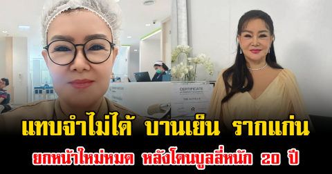 โอโหแทบจำไม่ได้ บานเย็น รากแก่น ยกหน้าใหม่หมด หลังโดนบูลลี่หนัก 20 ปี