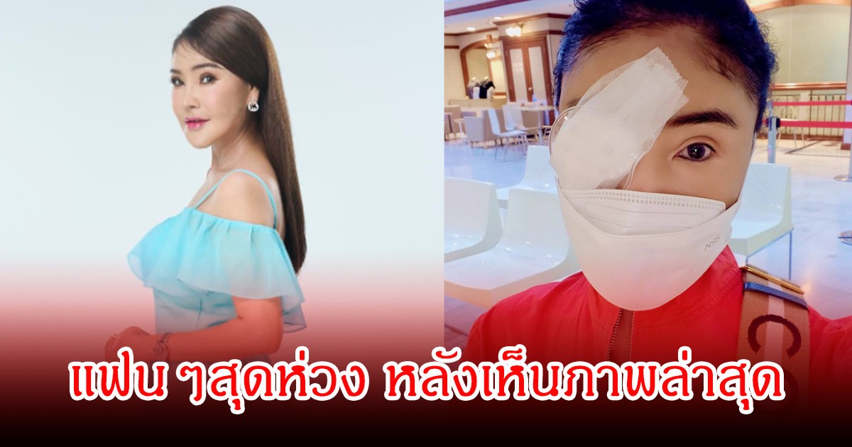 แฟนๆสุดห่วง หลังเห็นภาพล่าสุด ดาว มยุรีย์   ปิดตาพันแผล