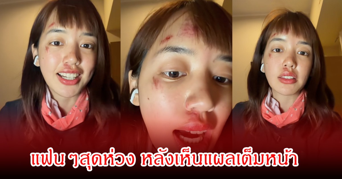 แฟนๆตกใจ พลอยไพลิน โพสต์คลิปล่าสุด แผลเต็มหน้า ชาวเน็ตคอมเมนต์สนั่นโซเซียล