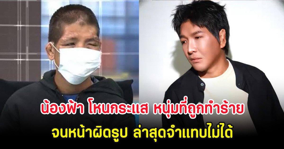 โอ้โห น้องฟ้า โหนกระแส หนุ่มที่ถูกนายจ้างทำร้ายจนหน้าผิดรูป ล่าสุดจำแทบไม่ได้