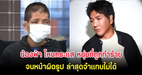 โอ้โห น้องฟ้า โหนกระแส หนุ่มที่ถูกนายจ้างทำร้ายจนหน้าผิดรูป ล่าสุดจำแทบไม่ได้