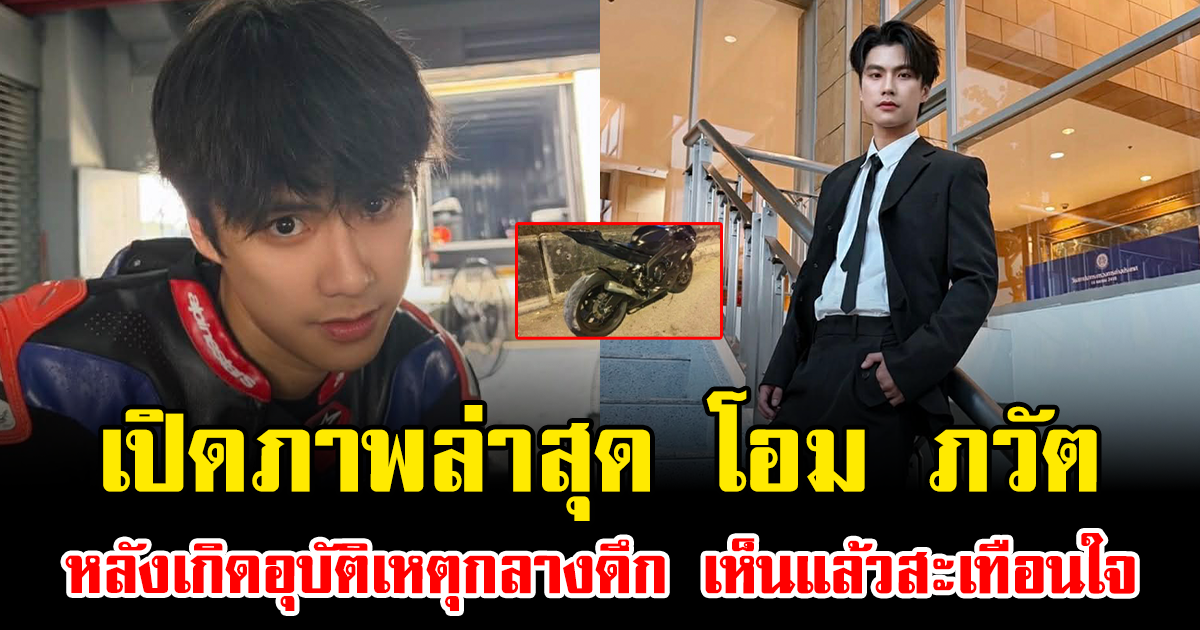 เปิดภาพล่าสุด โอม ภวัต หลังเกิดอุบัติเหตุกลางดึก เห็นแล้วสะเทือนใจ