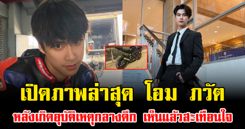 เปิดภาพล่าสุด โอม ภวัต หลังเกิดอุบัติเหตุกลางดึก เห็นแล้วสะเทือนใจ