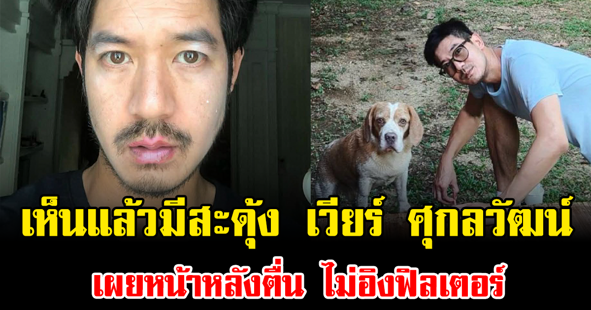 เห็นแล้วมีสะดุ้ง เวียร์ ศุกลวัฒน์ เผยหน้าหลังตื่น ไม่อิงฟิลเตอร์