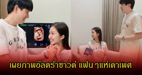 เบบี๋มาแล้ว อาชิ อาชิตา เผยภาพอัลตร้าซาวด์ แฟนๆแห่เดาเพศ หลังเคยสูญเสียลูก1ครั้ง