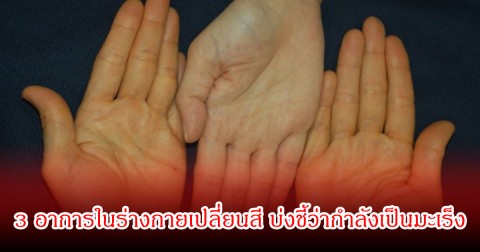 สัญญาณมรณะ! 3 อาการในร่างกายเปลี่ยนสี บ่งชี้ว่ากำลังเป็นมะเร็ง หลายคนเป็นไม่รู้