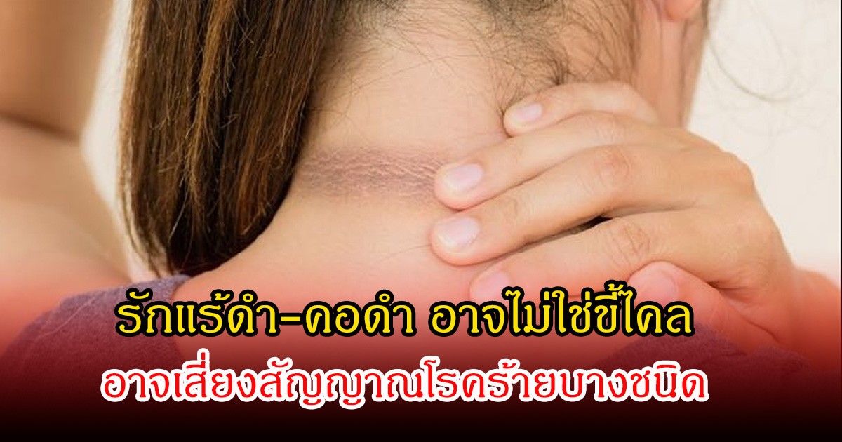 อย่าซะล่าใจ! รักแร้ดำ-คอดำ อาจไม่ใช่ขี้ไคล อาจเสี่ยงสัญญาณโรคร้ายบางชนิด