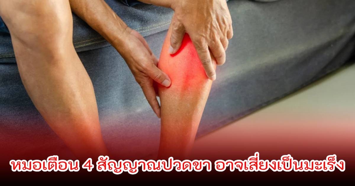 ปวดขา อย่าคิดว่าเรื่องเล็ก! หมอเตือน 4 สัญญาณ อาจเสี่ยงเป็นมะเร็ง เผยอาการแบบไหนควรรีบพบแพทย์