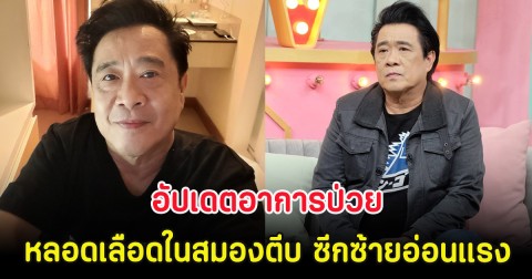 นักร้องยุค 80 อัปเดตอาการป่วยหลอดเลือดในสมองตีบ ซีกซ้ายอ่อนแรง