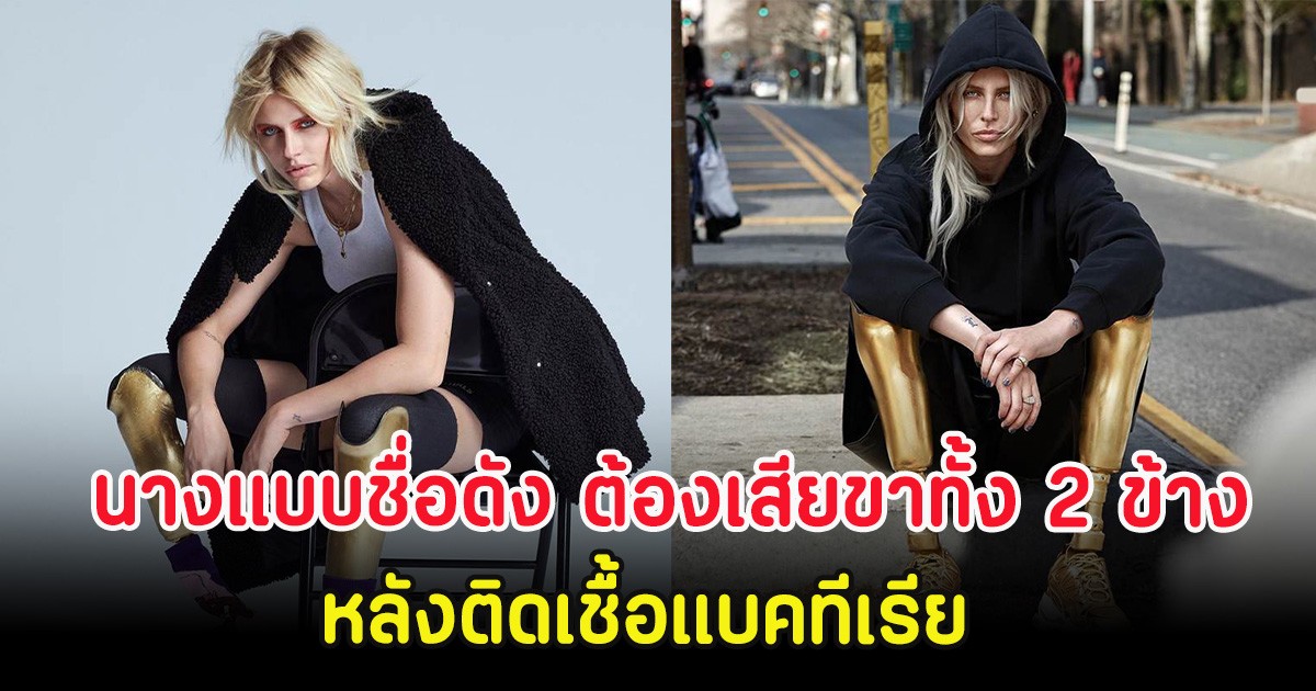 ช็อก นางแบบชื่อดัง ต้องเสียขาทั้ง 2 ข้าง หลังติดเชื้อแบคทีเรีย (ตปท.)