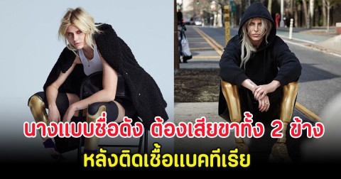 ช็อก นางแบบชื่อดัง ต้องเสียขาทั้ง 2 ข้าง หลังติดเชื้อแบคทีเรีย (ตปท.)