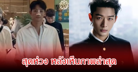 แฟนๆสุดห่วง! ภาพล่าสุด พระเอกดัง หลังเกิดอุบัติเหตุระหว่างการถ่ายทำในกองถ่าย (ข่าวต่างประเทศ)