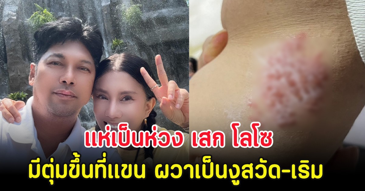แห่เป็นห่วง เสก โลโซ มีตุ่มขึ้นที่แขน ผวาเป็นงูสวัด-เริม