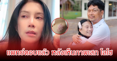 แพทย์ตอบแล้ว หลังกานต์ โพสต์ภาพแขน เสก โลโซ มีผื่นและตุ่มใสขึ้นปริศนา ทำแฟนๆน่าห่วงเพียบ