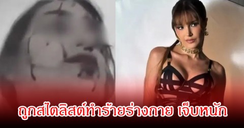 ช็อก! นางงามดัง ถูกสไตลิสต์ทำร้ายร่างกาย เจ็บหนัก  (ข่าวต่างประเทศ)