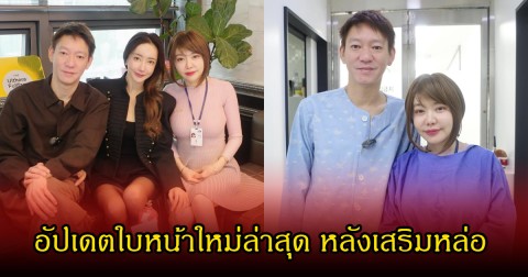 จิน จรินทร์ ธรรมวัฒนะ อัปเดตใบหน้าใหม่ล่าสุด หลังเสริมหล่อ ออร่าพุ่งจนจำแทบไม่ได้