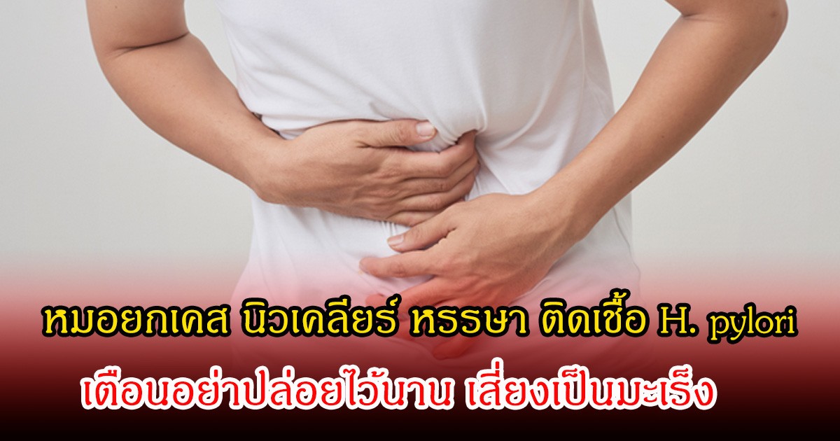 หมอยกเคส นิวเคลียร์ หรรษา ติดเชื้อ H. pylori  เตือนอย่าปล่อยไว้นาน เสี่ยงเป็นมะเร็ง