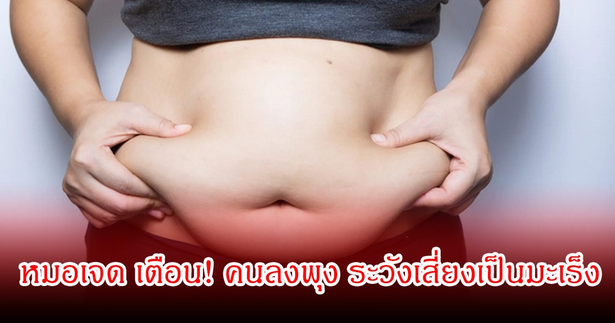 หมอเจด เตือน! คนลงพุง ระวังเสี่ยงเป็นมะเร็ง