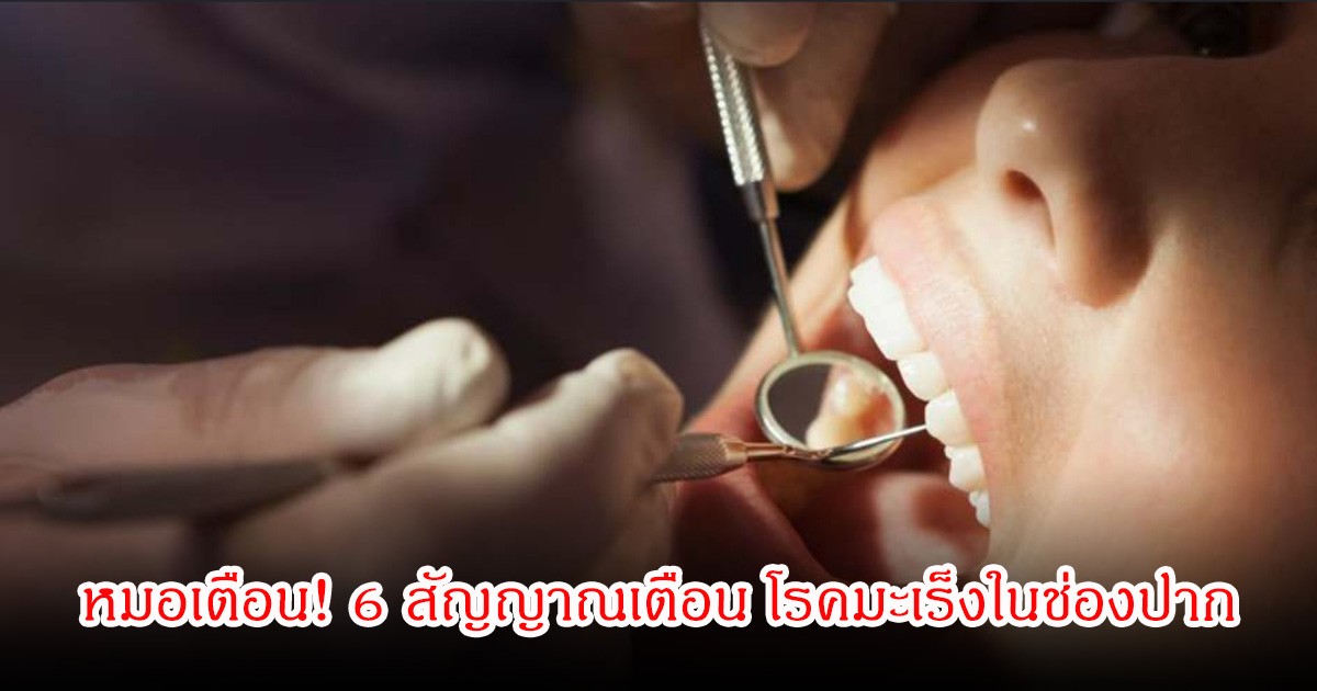 หมอเตือน! 6 สัญญาณเตือน โรคมะเร็งในช่องปาก