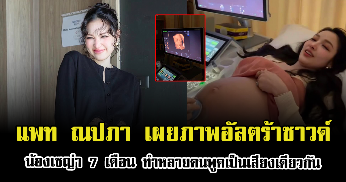 แพท ณปภา เผยภาพอัลตร้าซาวด์ น้องเซญ่า 7 เดือน หลายคนถึงกับพูดเป็นเสียงเดียวกัน
