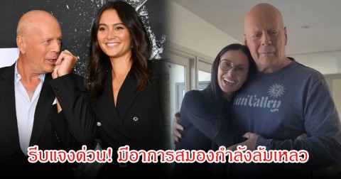 ภรรยาของนักแสดงชื่อดัง รีบแจงด่วน! มีอาการสมองกำลังล้มเหลว แต่ไม่ได้ทำให้สูญเสียความทรงจำ (ข่าวต่างประเทศ)