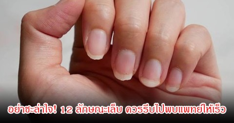 อย่าชะล่าใจ! 12 ลักษณะเล็บ ควรรีบไปพบแพทย์ให้เร็ว