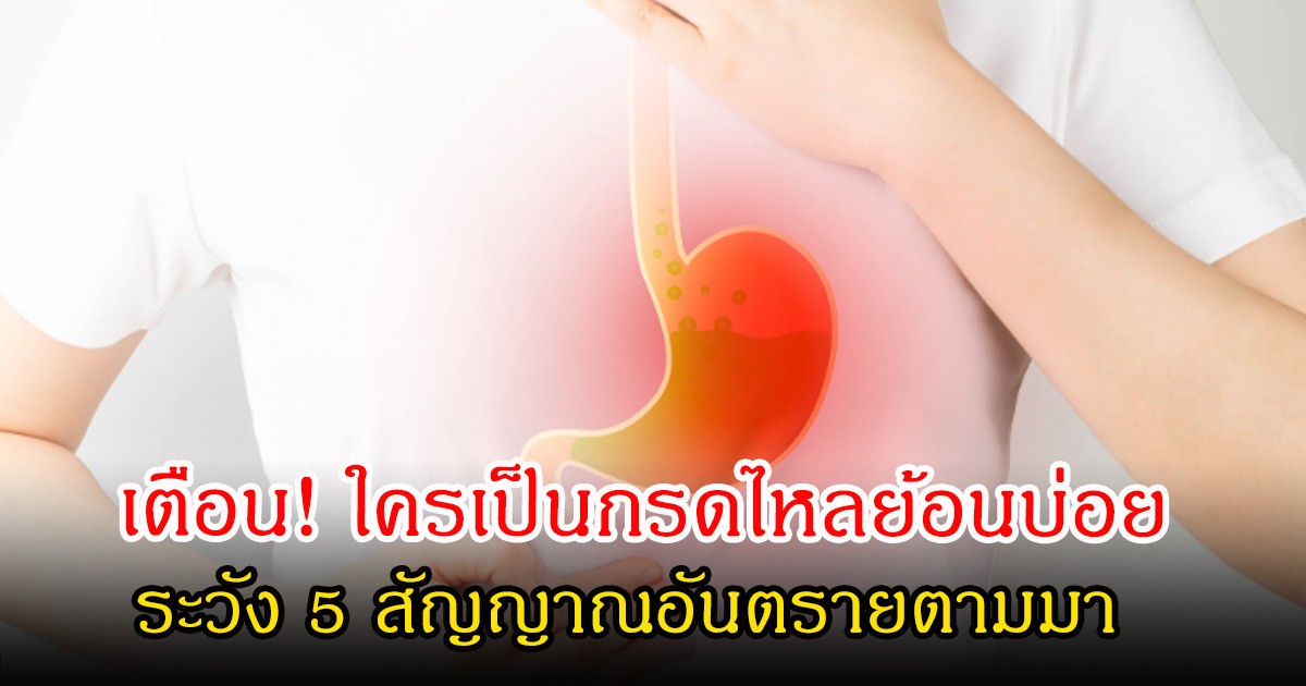 ใครเป็นกรดไหลย้อนบ่อย ระวัง 5 สัญญาณอันตรายตามมา หลายคนเป็นไม่รู้ตัว