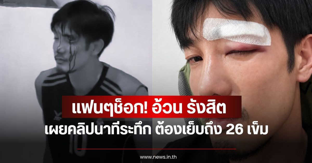 แฟนๆช็อก! อ้วน รังสิต เผยคลิปนาทีระทึก เลือดอาบหน้า ต้องเย็บถึง 26 เข็ม